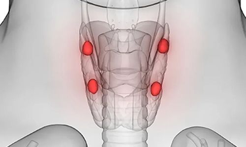 Paratiroid Bezi Hastalıklarında Tanı